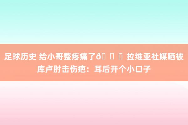 足球历史 给小哥整疼痛了😅拉维亚社媒晒被库卢肘击伤疤：耳后开个小口子